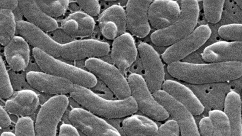 FILE - This 2005 electron microscope image provided by the Centers for Disease Control and...