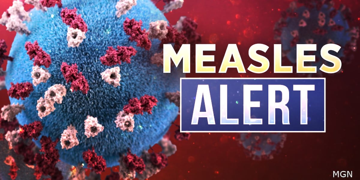 Measles outbreak reported in Central Kentucky