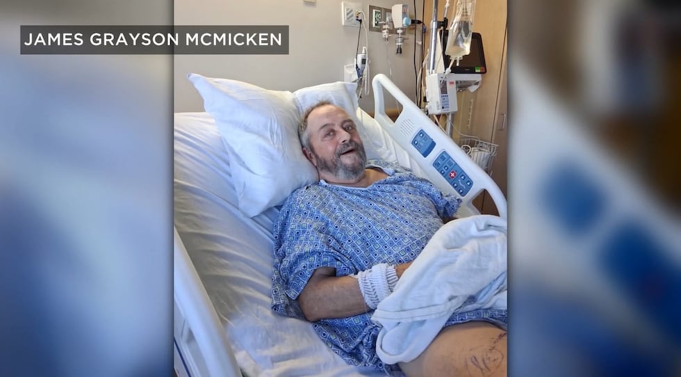 James Grayson McMicken, 71, is lucky to be alive after an alligator attack turned a quiet...